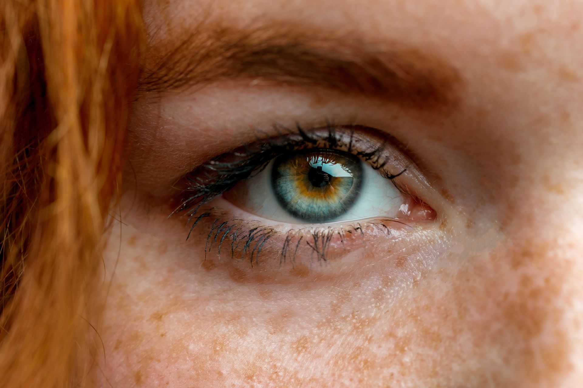close up of woman with hazel eyes - Eyesthetics oculoplastic surgery