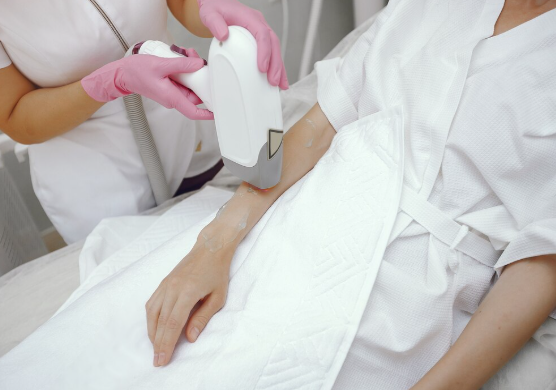 painless laser hair removal
