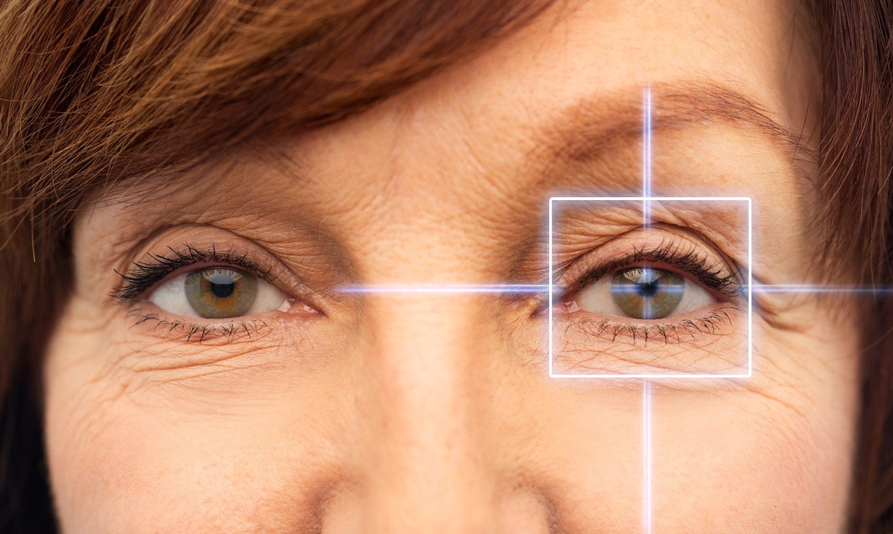 orbital disorders treated by eyesthetics