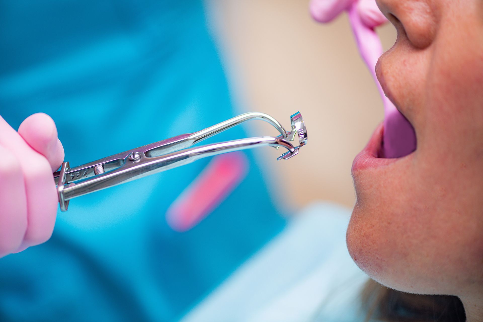 Root canal instrumets in front of a patient.