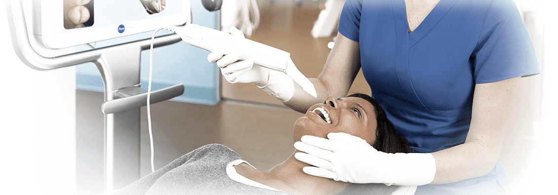 ITero Intraoral Scanner in Columbia MD - Dentist