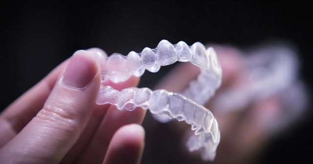 How Much Does Invisalign® Cost & Other Frequently Asked Questions: A  Complete Guide to Invisalign