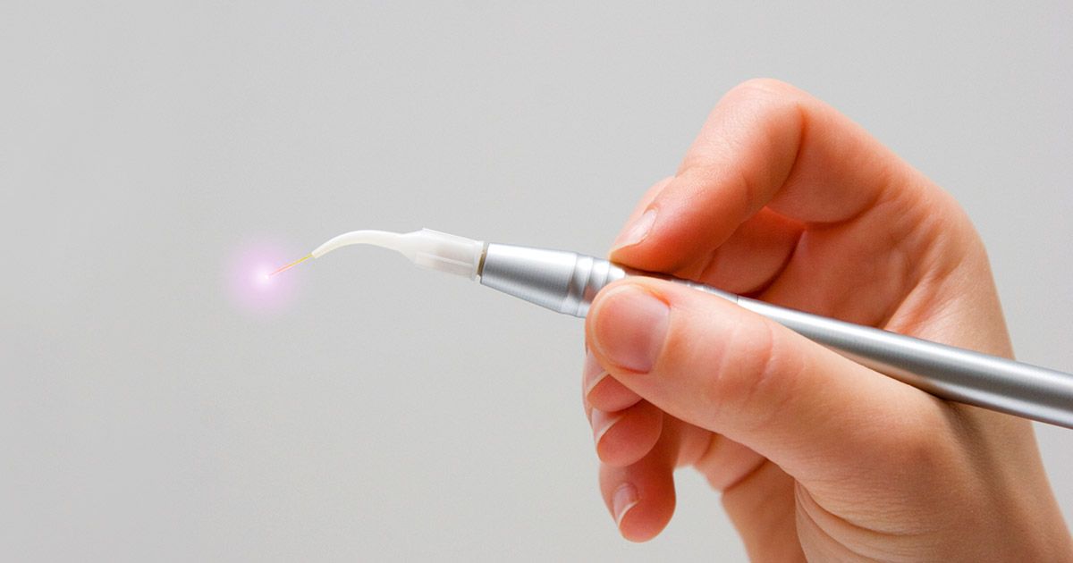 laser treatment for periodontal disease
