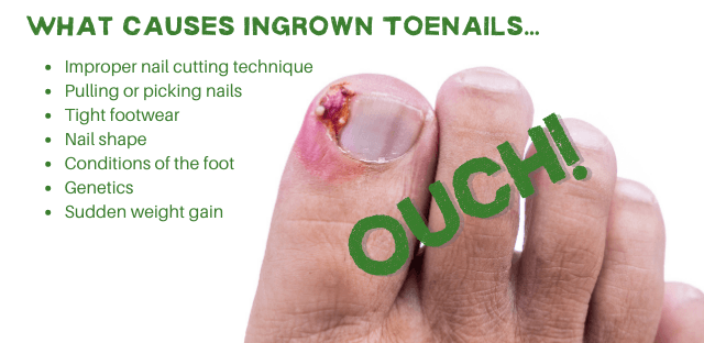 Ingrown Toenail...the who, the what and the nasty!