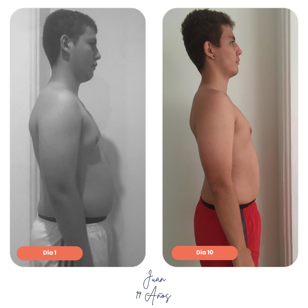 Comparativa de antes y después en paciente hombre que siguió Ken Diet System