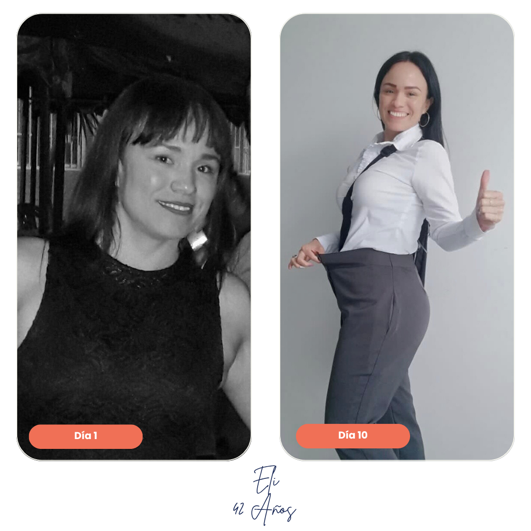 Resultados en figura femenina tras seguir el tratamiento Ken Diet System durante 10 días