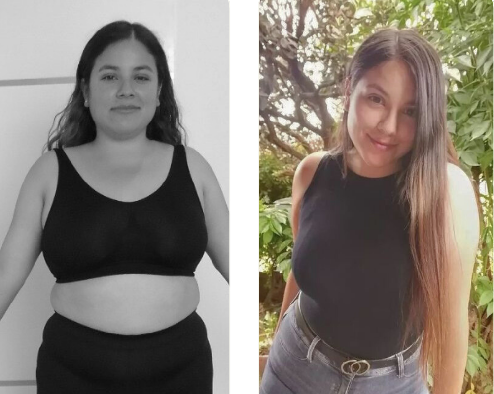 Imágenes de cambio corporal en paciente mujer que aplicó Ken Diet System con seguimiento