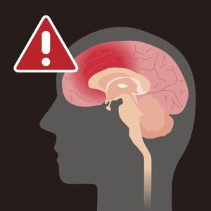 Recognizing Symptoms of a Traumatic Brain Injury cardaro & peek