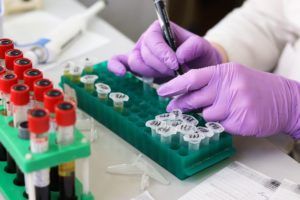 Laboratory Errors Impact Medical Treatment