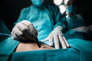 Medical Malpractice: Unnecessary Surgeries