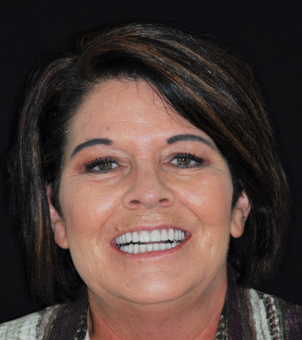 Woman smiling, with well-aligned teeth, wearing a patterned jacket, against a black backdrop.