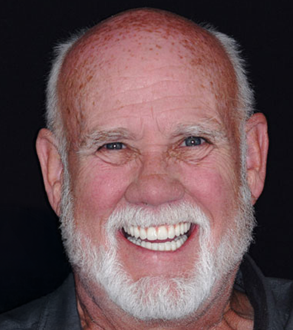 Smiling man with white beard and teeth, wearing a dark shirt.