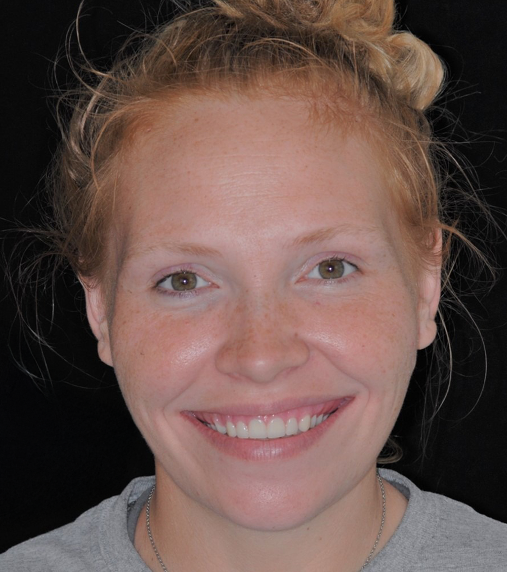 Woman with reddish-blonde hair in a bun smiles, showing teeth, against a black background.