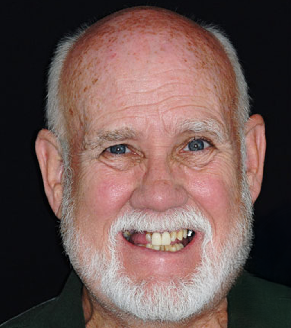 Older man with a white beard, smiling, and missing some teeth. He's wearing a green shirt.