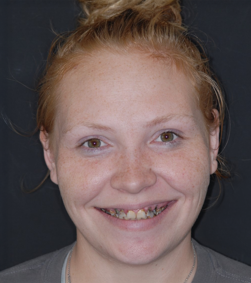 Woman smiling, showing braces; ginger hair pulled up; against a dark background.