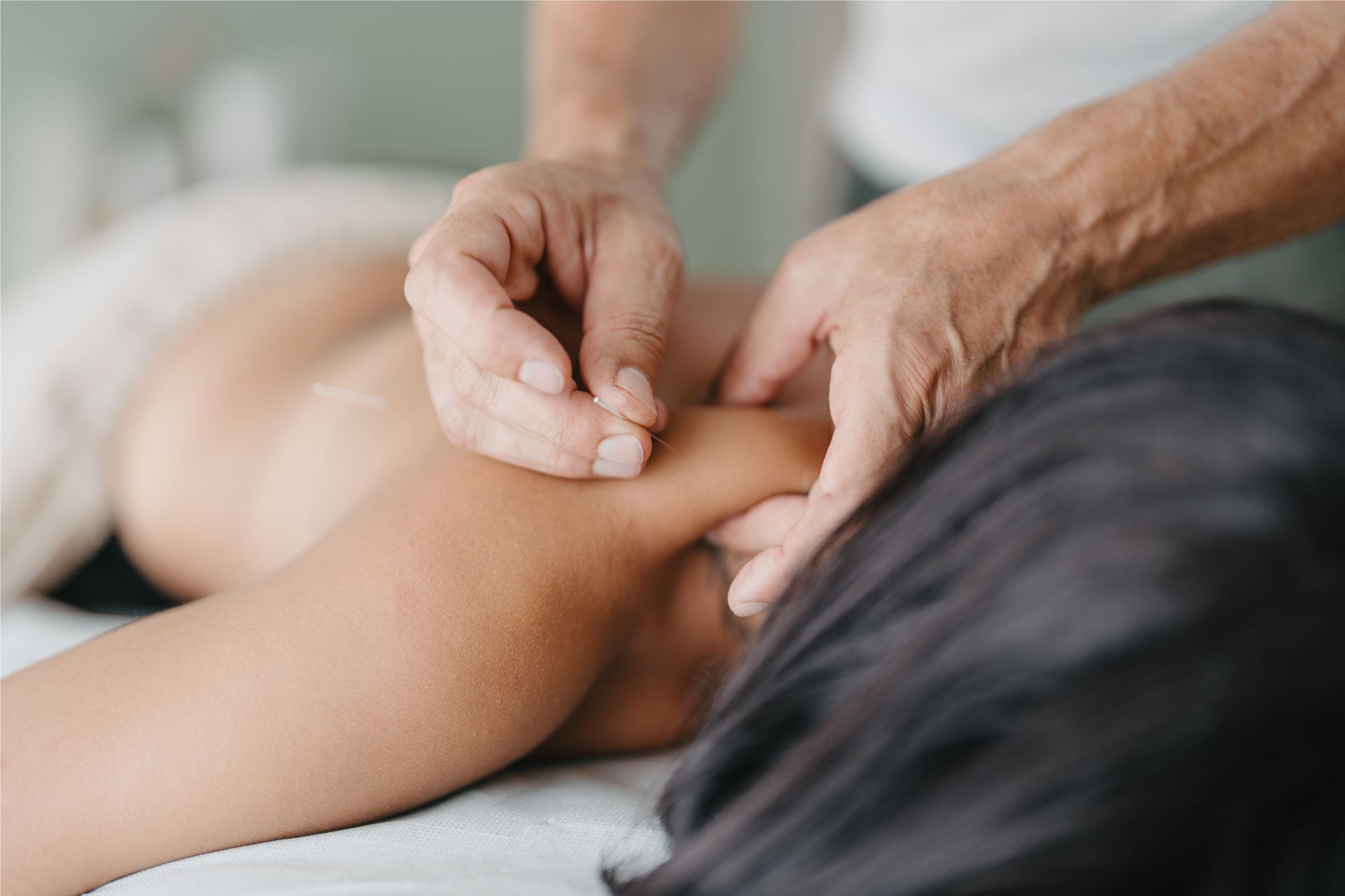 Acupuncturist inserts acupuncture needle to a patient