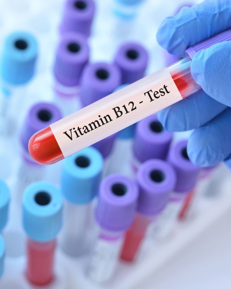 Vitamin B12 blood test tube