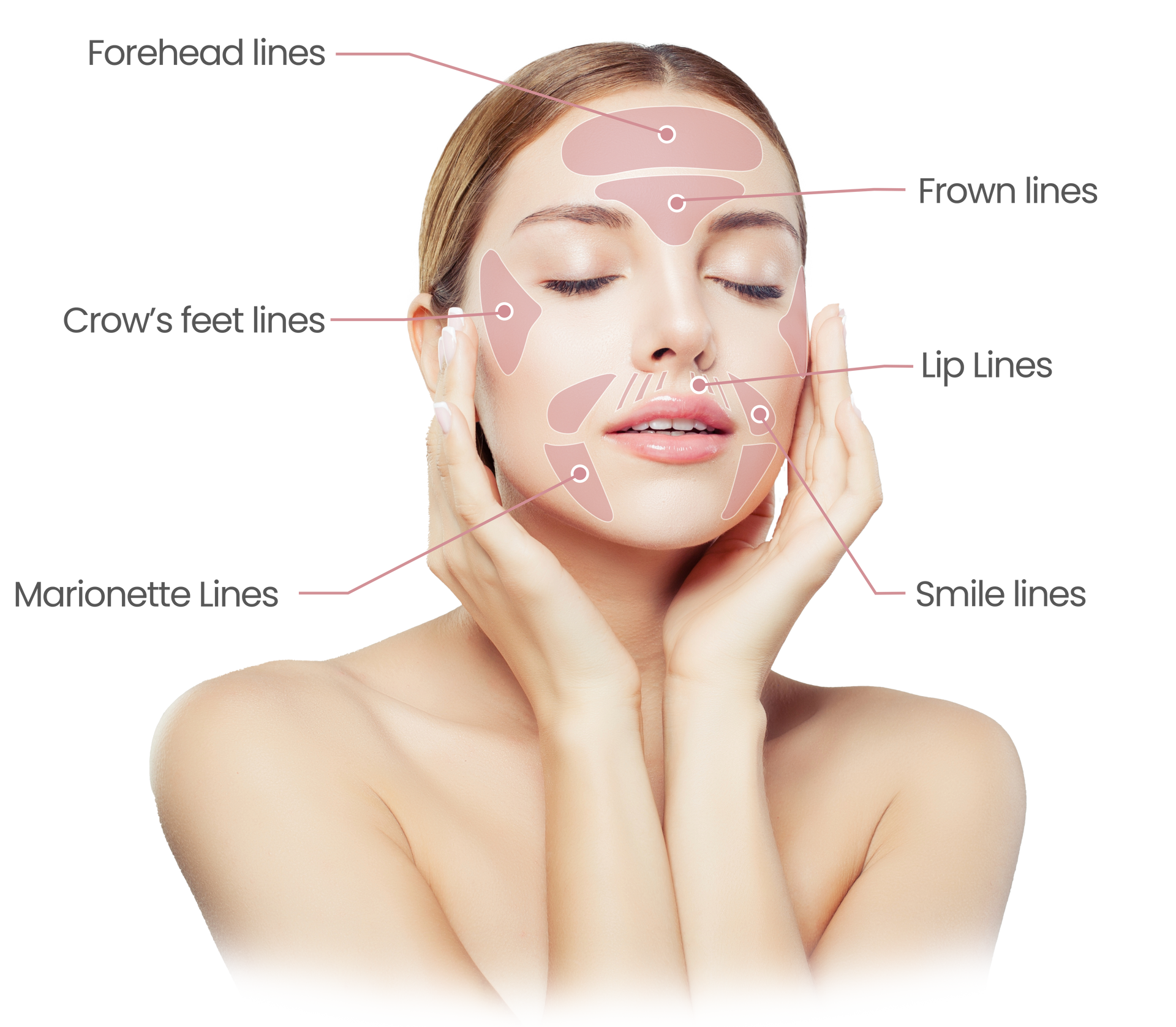 Common problem areas for fine lines.