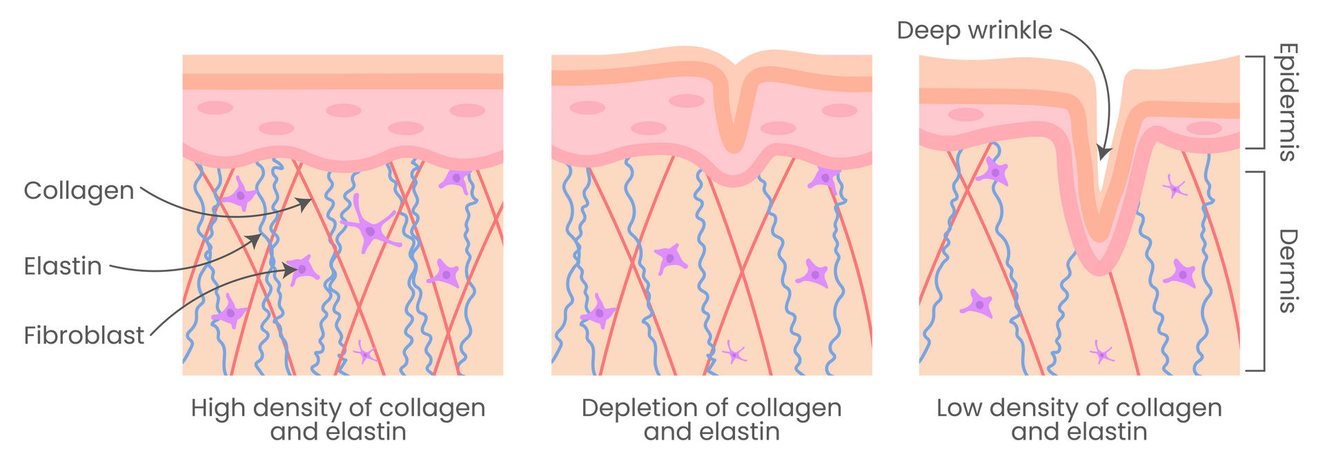 skin ageing illustration