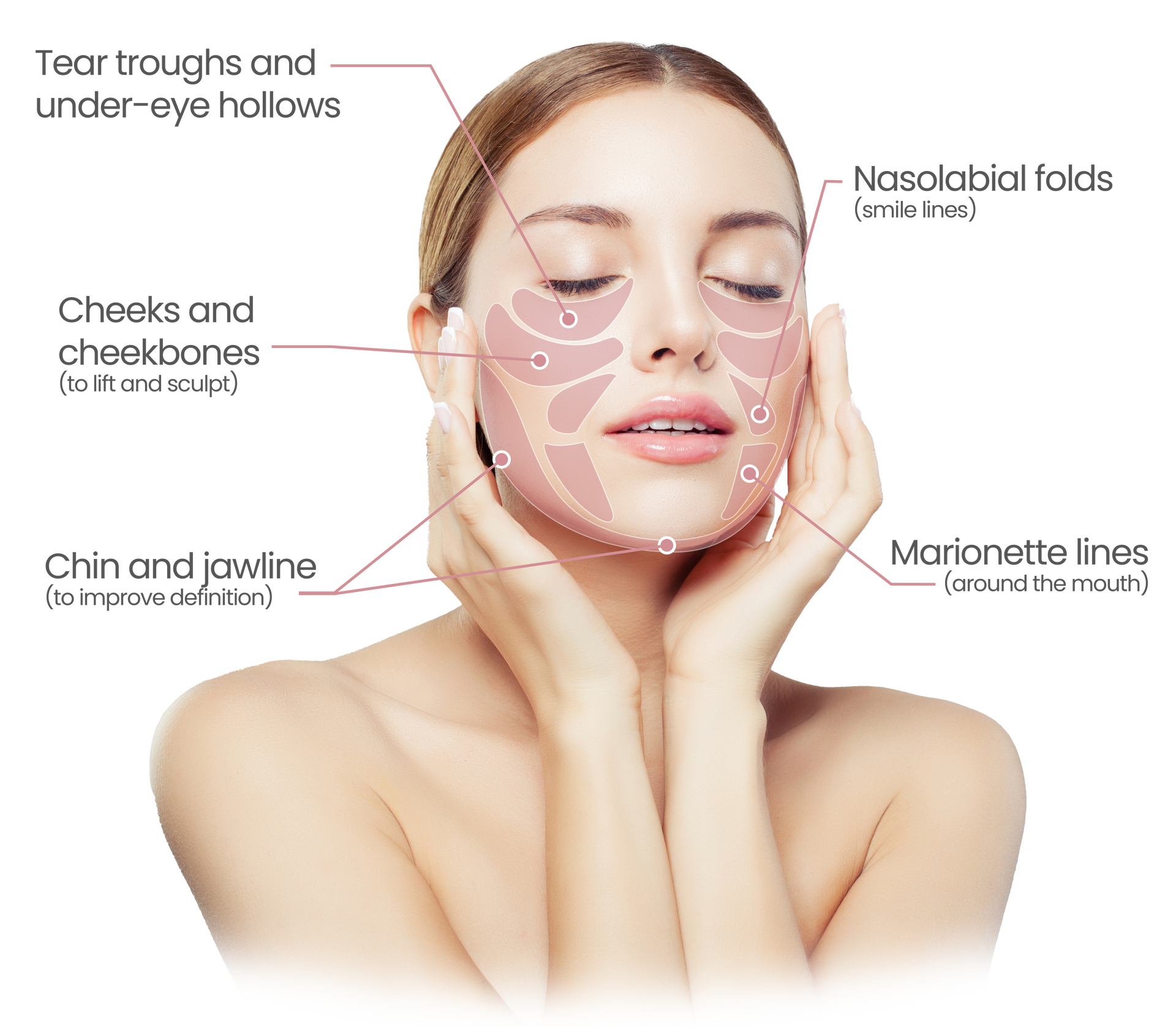 dermal volumiser target areas
