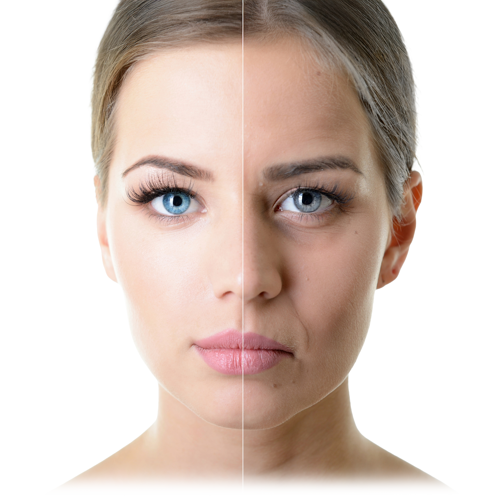 fine lines common problem areas