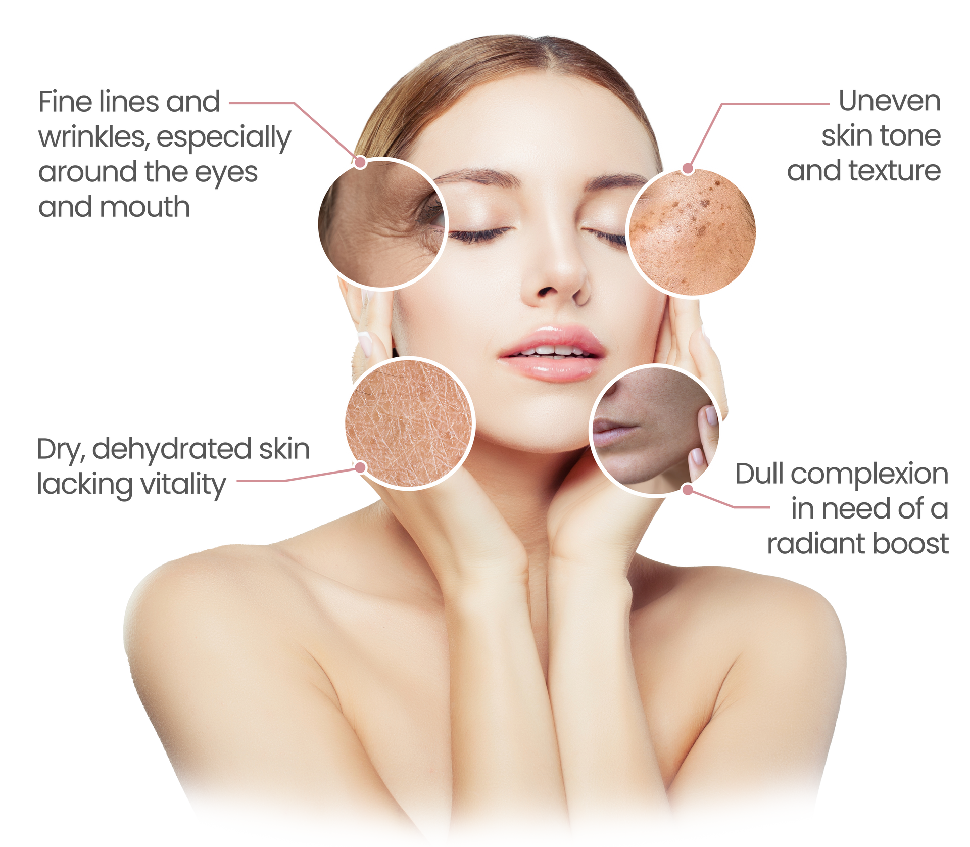 Skin Boosters Target Areas