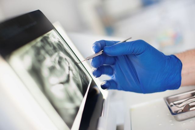 Mano guantata che contrassegna una pellicola radiografica su un tavolo luminoso in un ambiente medico.