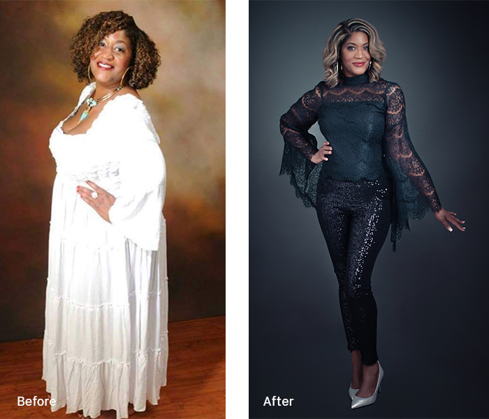 A before and after photo of a woman in a white dress and black pants by slim4life weight loss