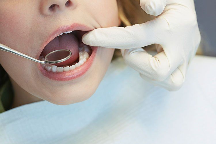 dentist about to check patient teeth