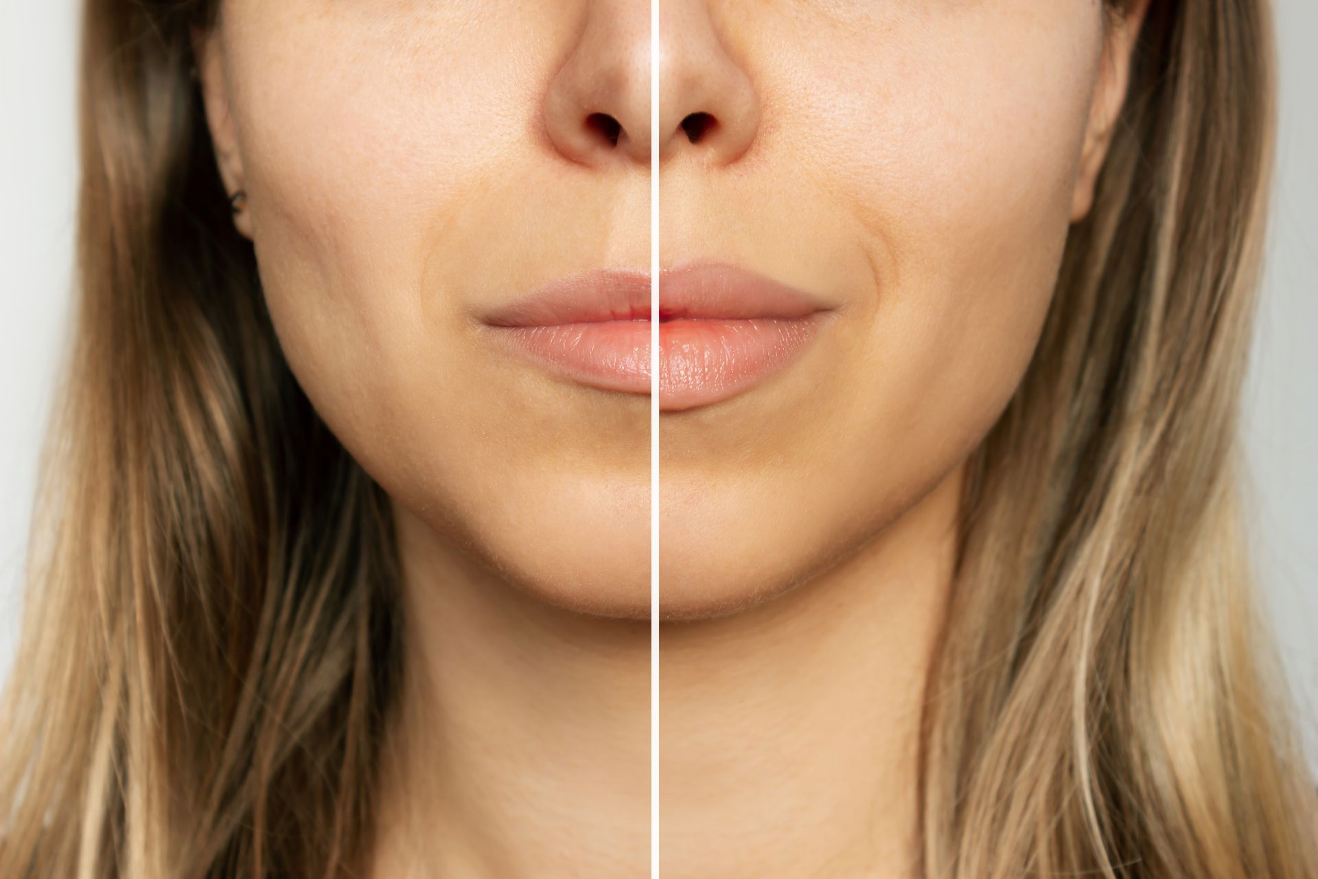 Close-up split face comparison: lighter complexion on the left, darker with tan lines on the right.