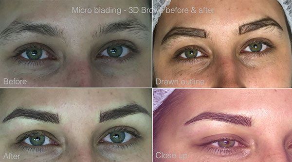 Micro Blading — Eyebrows Before and After in South Fargo, ND