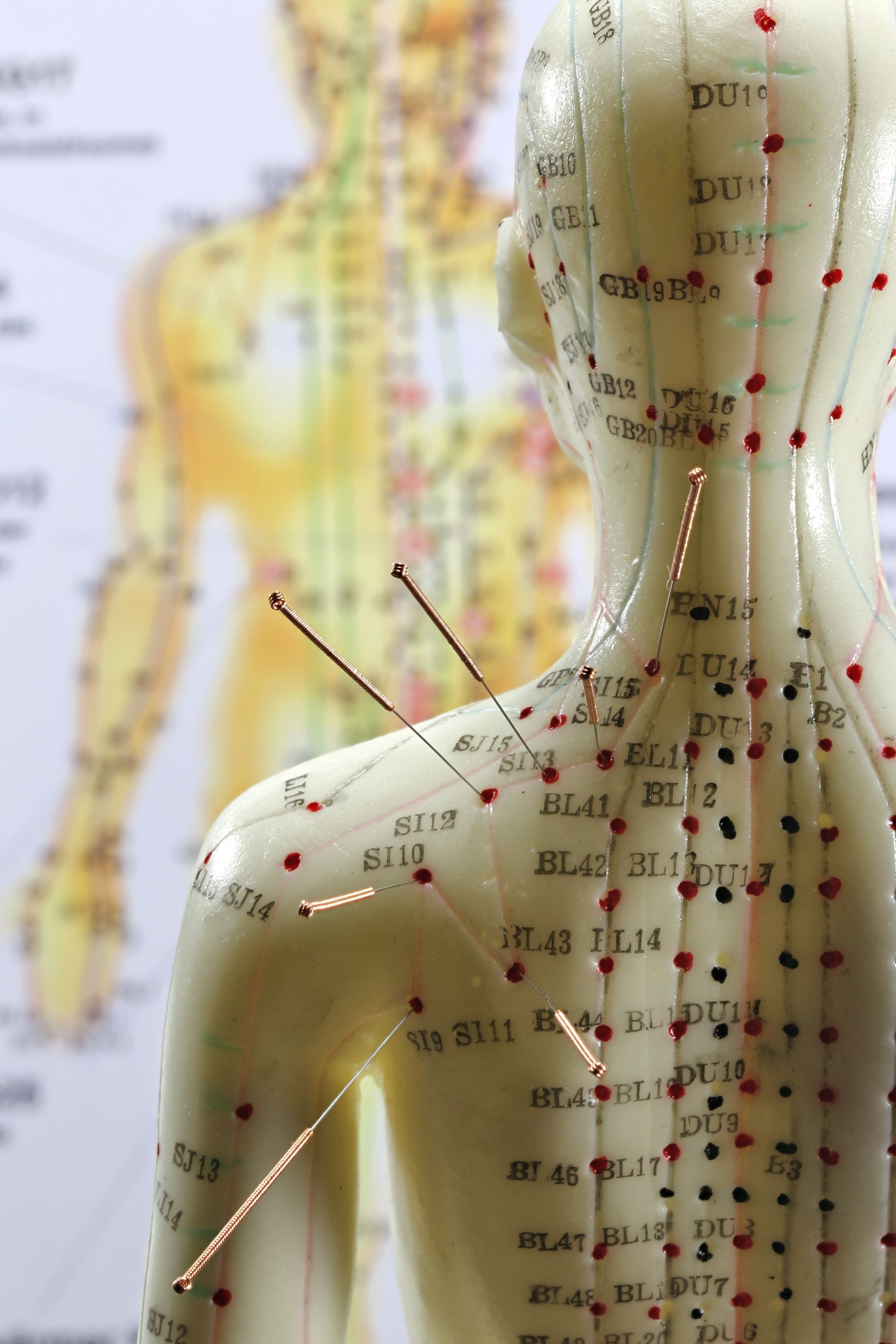 a model of a person with acupuncture needles on it 
