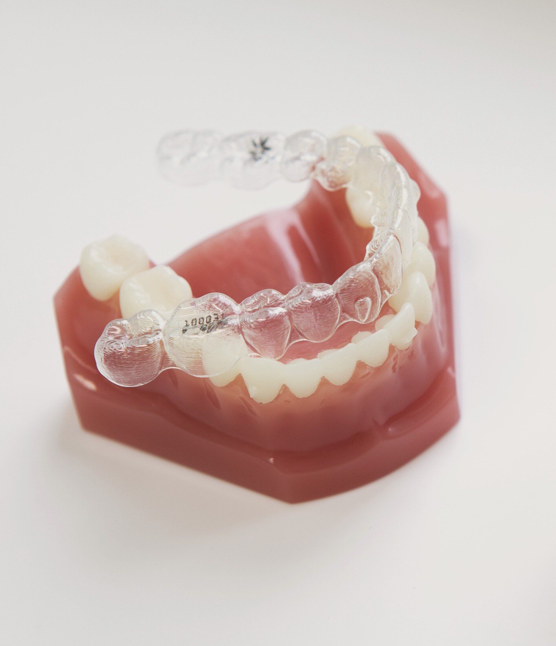 Ortodonzia mobile invisibile