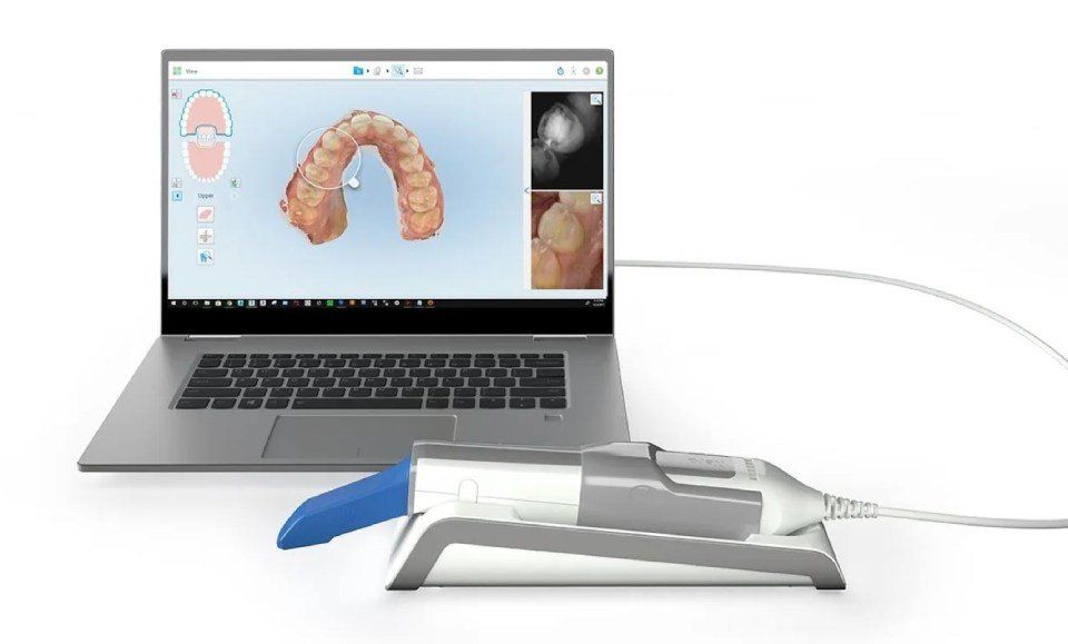studio di un'impronta dentale