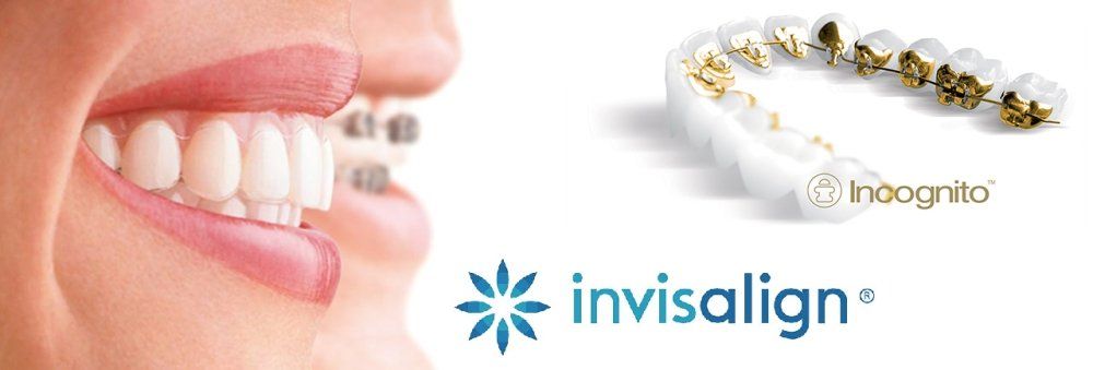 invisalign