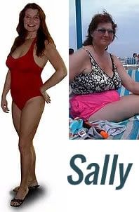 Before and After of Sally Guyder