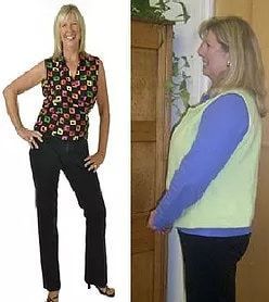 Before and After of Sue Tillotson