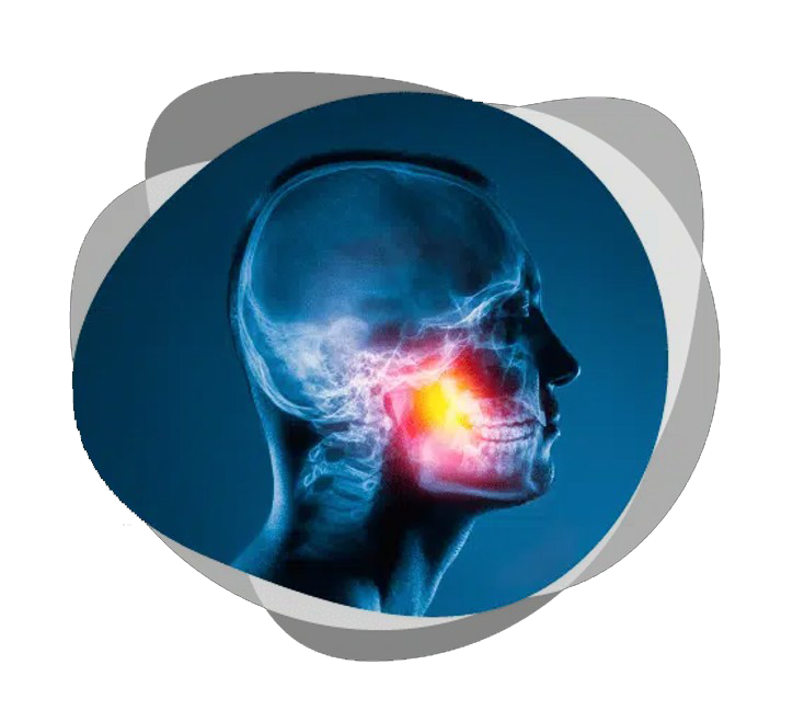 Sleep Apnea xray scan — Frankfort, IL — Brookside Dental Care