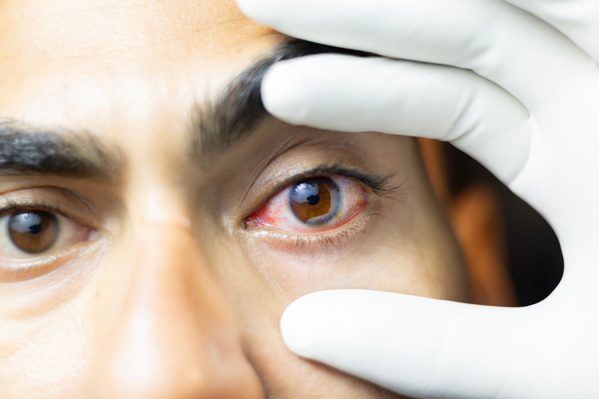 Eye Injury - Midland, TX - The Eye Institute