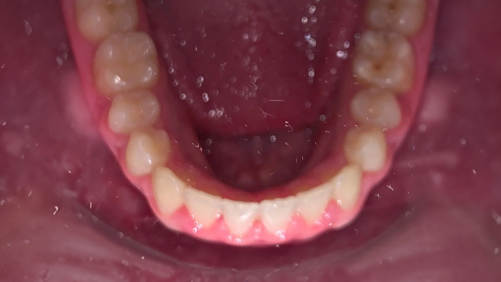A close up of a man 's teeth with a beard.