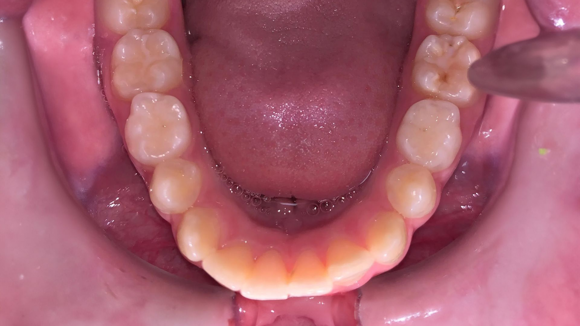 A close up of a man 's teeth with a beard.
