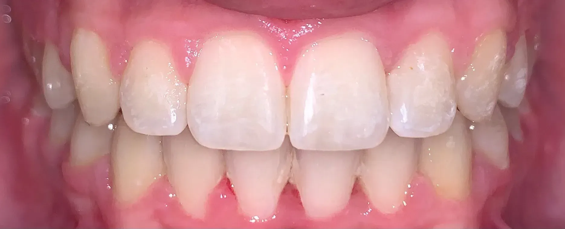 A close up of a man 's teeth with a beard.