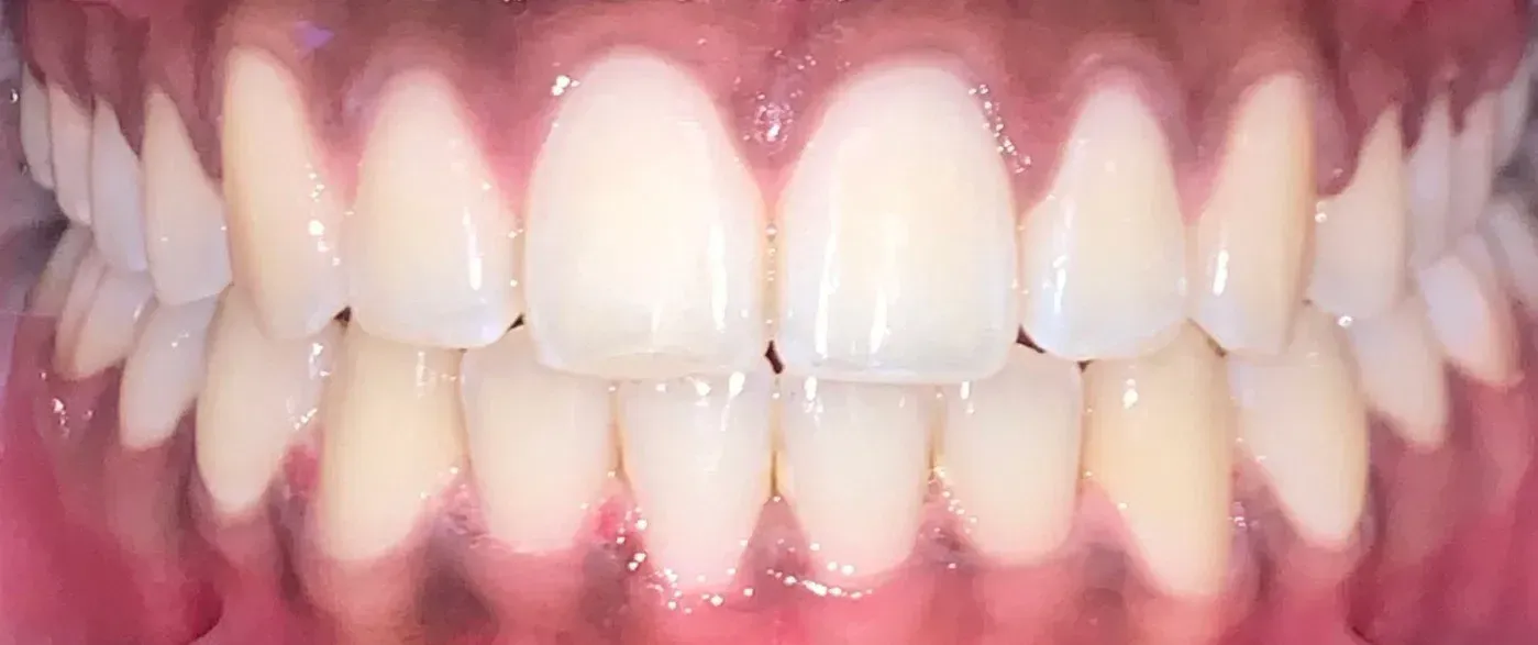 A close up of a man 's teeth with a beard.
