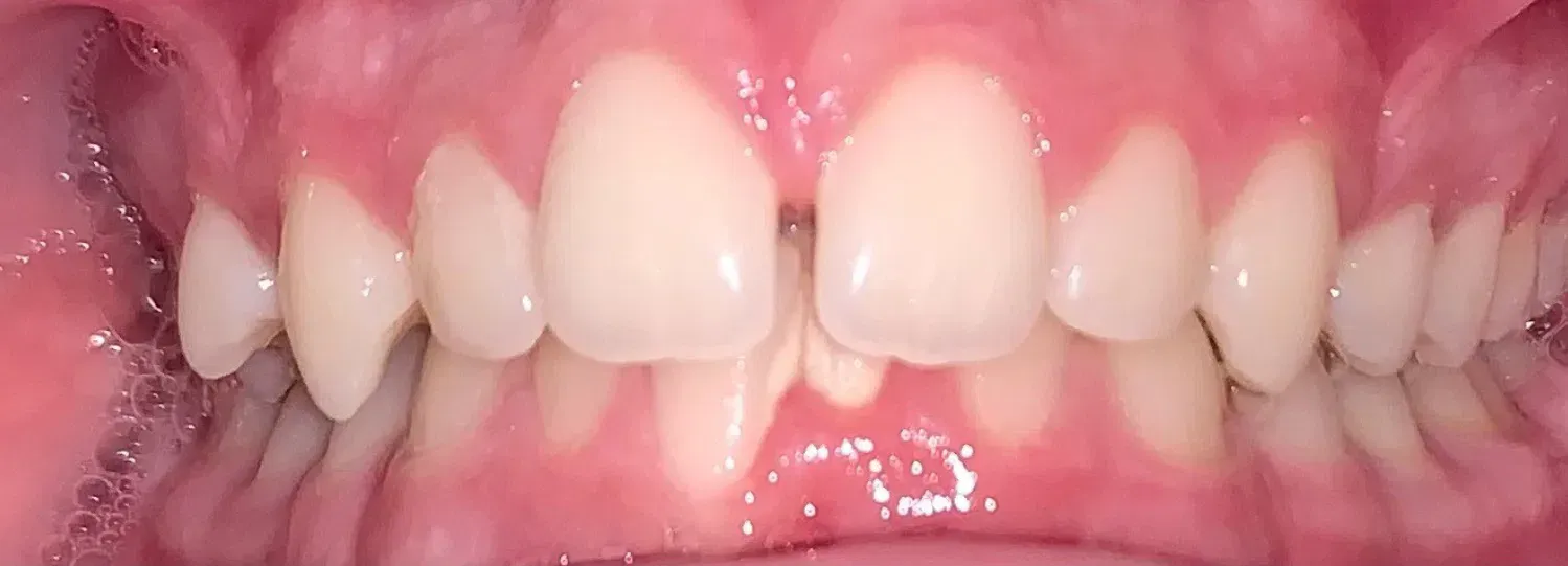 A close up of a man 's teeth with a beard.