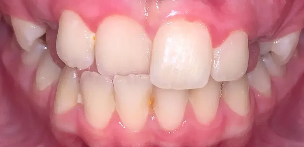 A close up of a man 's teeth with a beard.