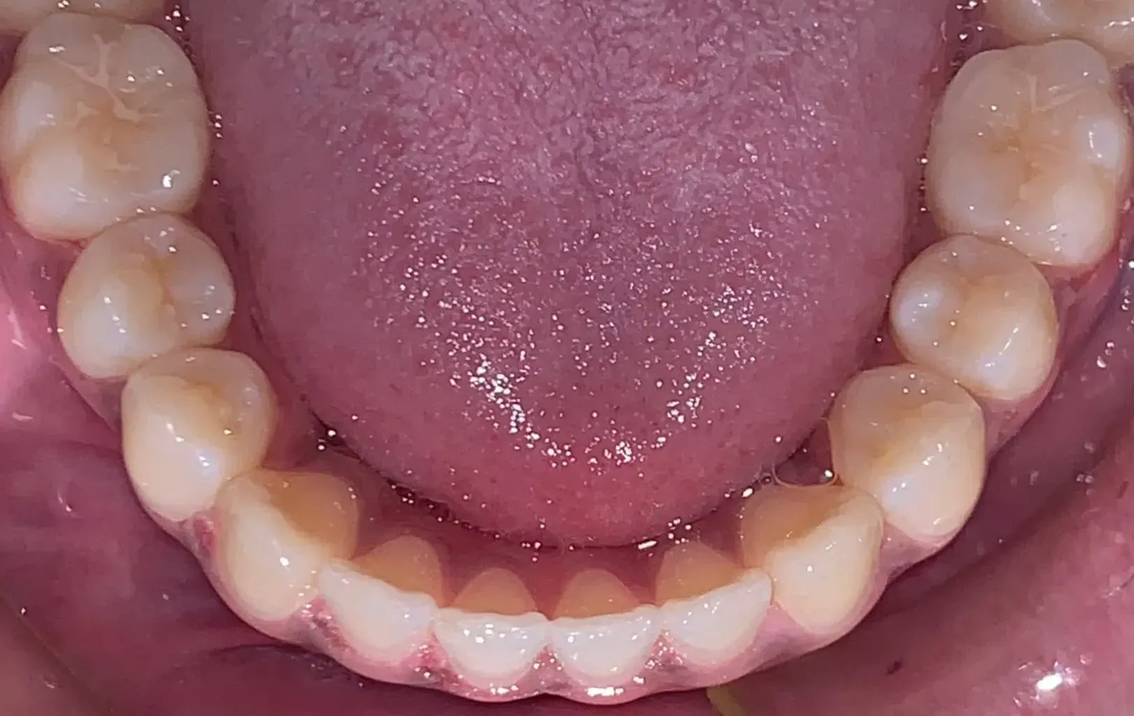 A close up of a man 's teeth with a beard.