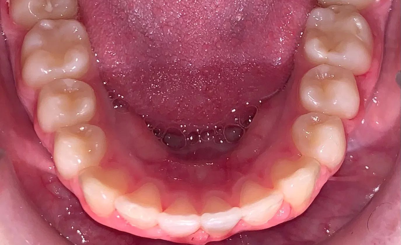 A close up of a man 's teeth with a beard.