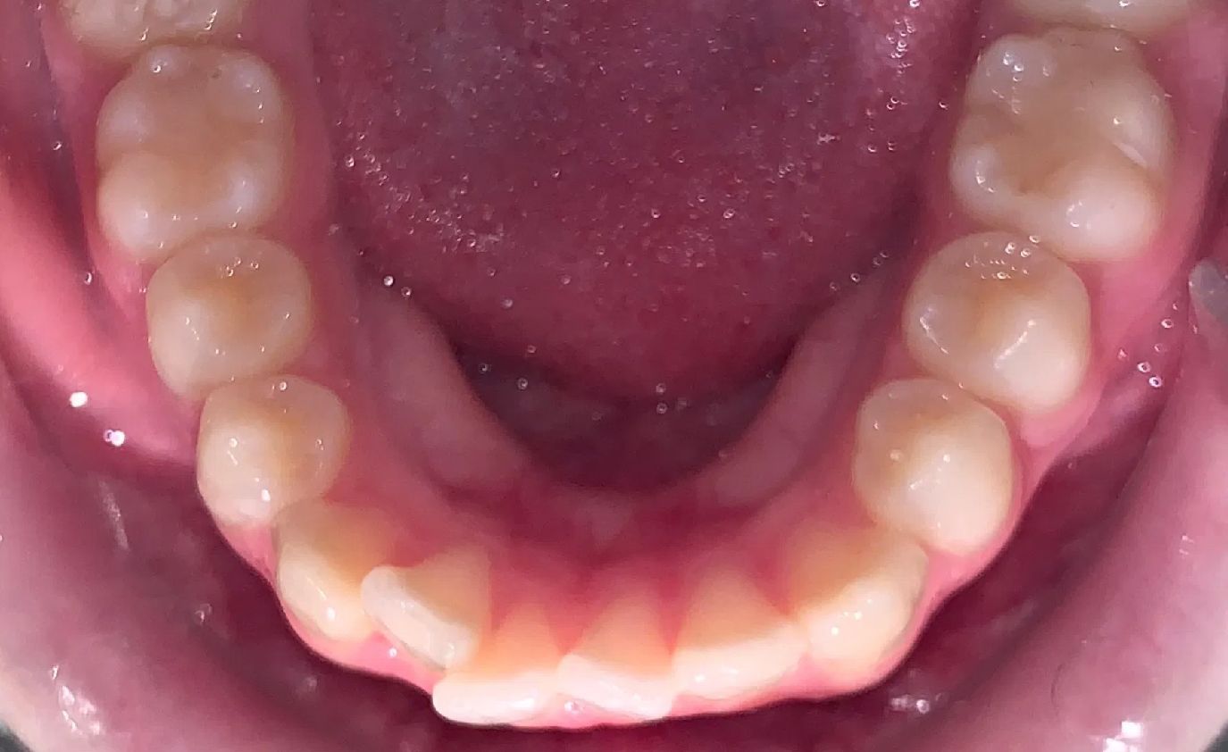 A close up of a man 's teeth with a beard.