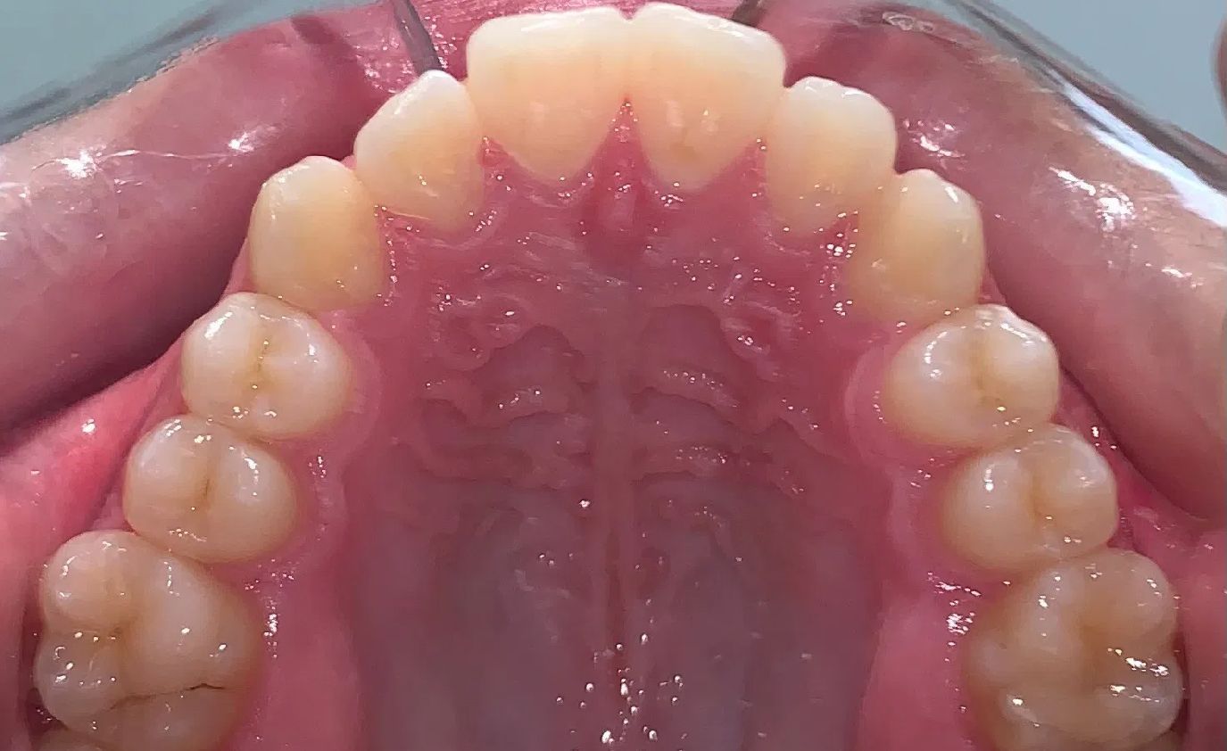 A close up of a man 's teeth with a beard.