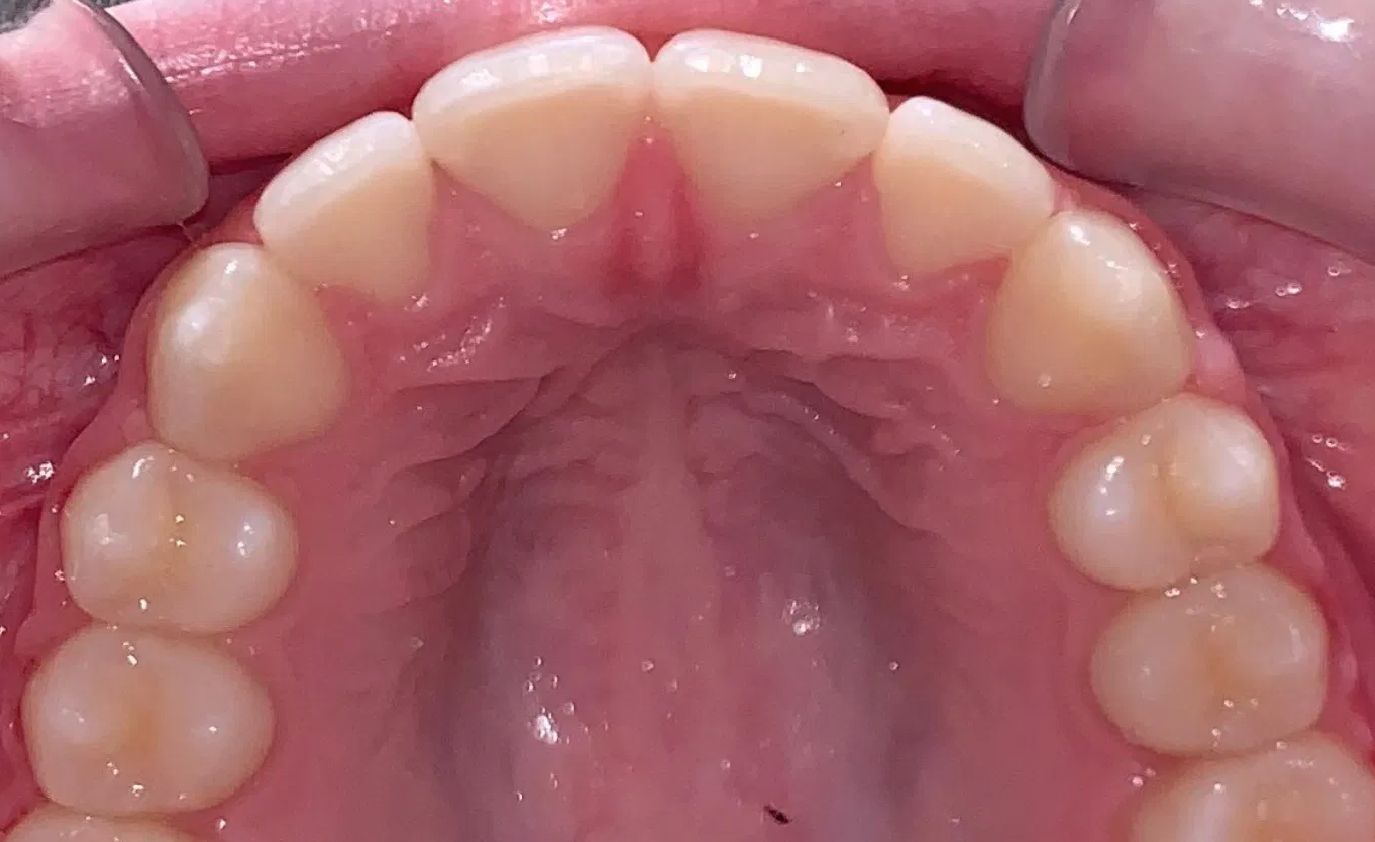 A close up of a man 's teeth with a beard.